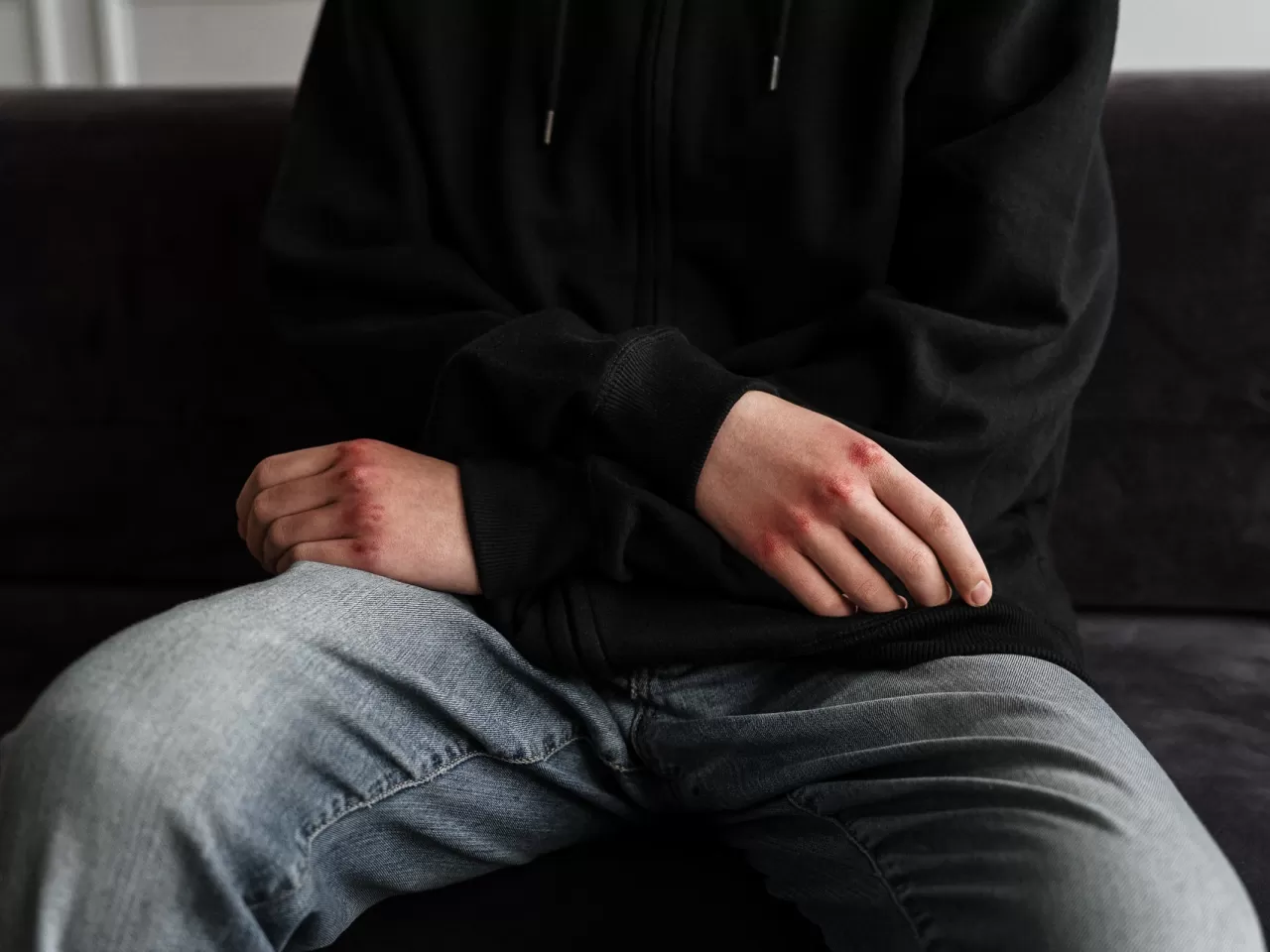 saldırganlık görülmüyor