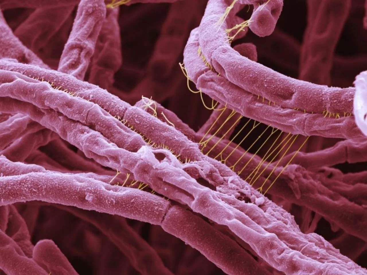 Бактерия вызывающая язву. Bacillus anthracis. Bacillus anthracis, а22 (Сибирская язва).