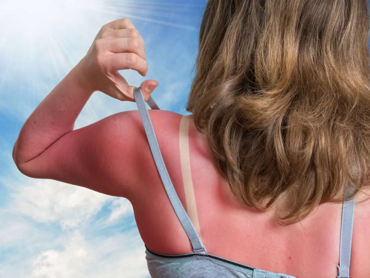 Öncelikle Kendimizi Güneşten Koruyalım Ama Nasıl?