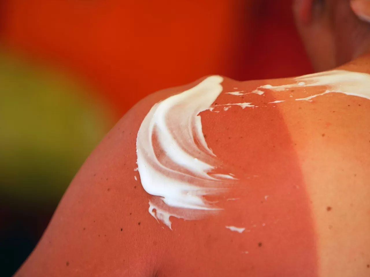 Evde Uygulanan Tedavi Sonrasında;