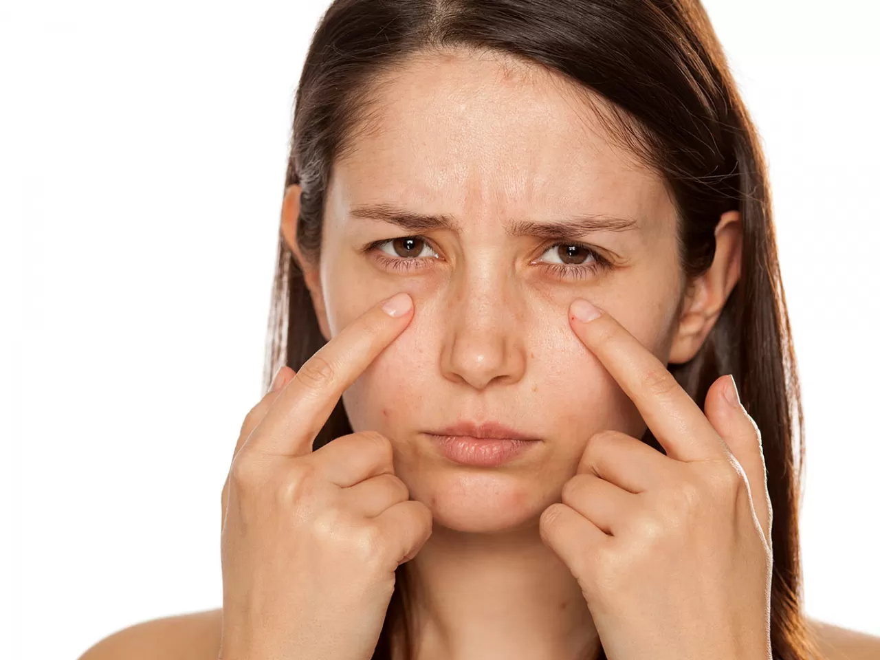 Neden Göz Altı Morlukları Oluşur?