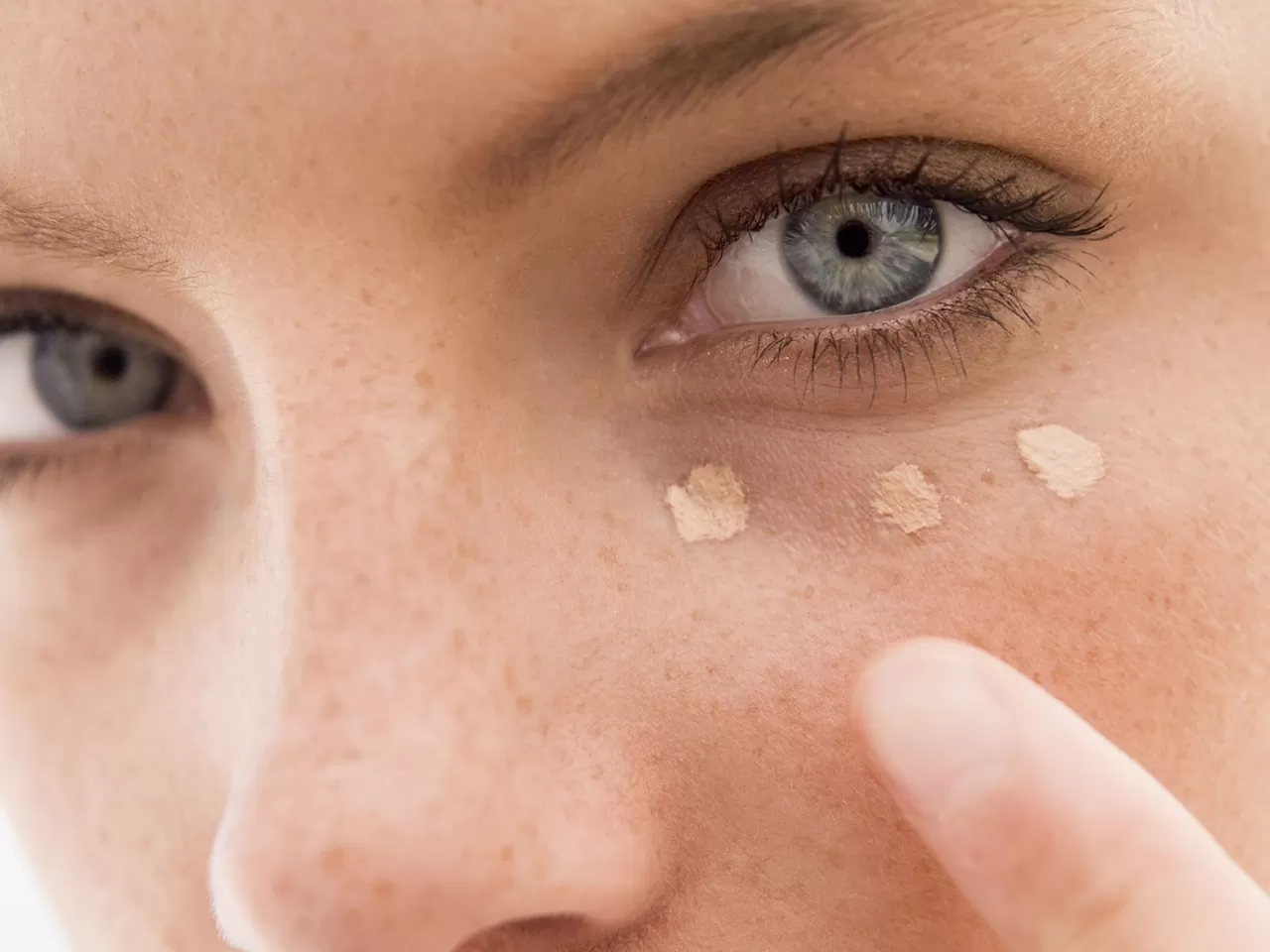 Göz Altı Morluklarının Oluşmaması İçin Neler Yapılabilir?