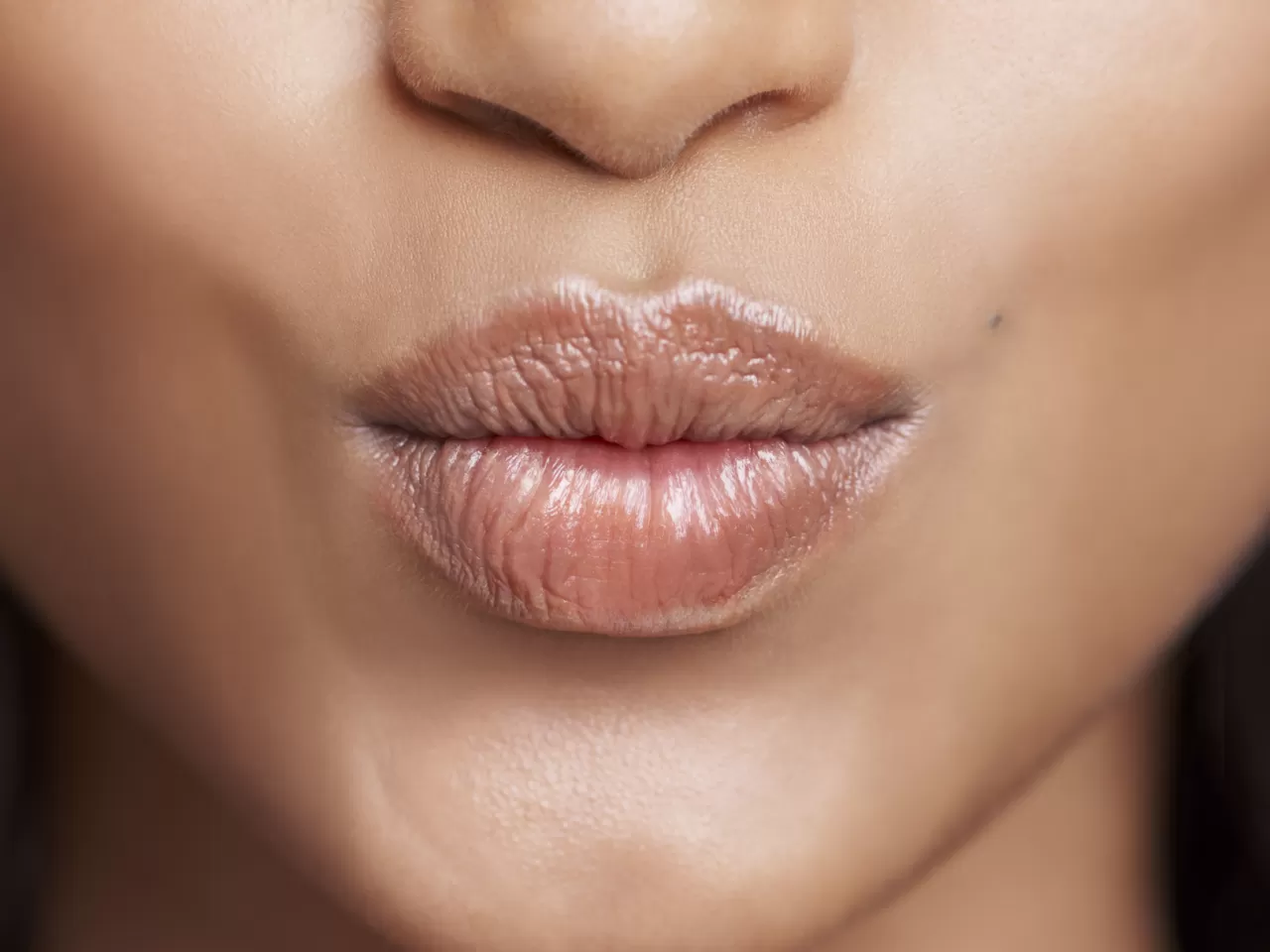 Dudak Üstü Kırışıklıklarını Önlemek İçin Neler Yapılabilir?