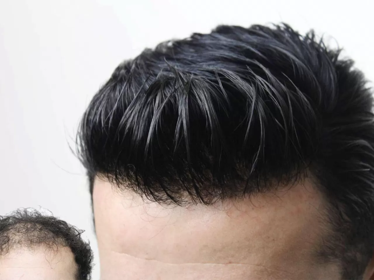 Protez Saç Bakımı Nasıl Yapılır?