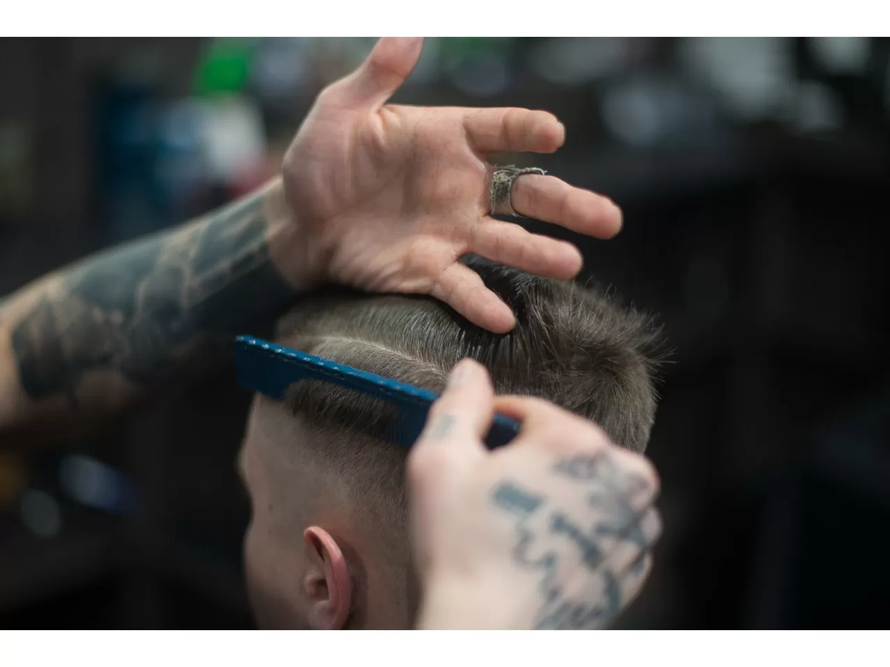 Erkeklerde Saç Kepeği Ne Zaman Görülmeye Başlar?