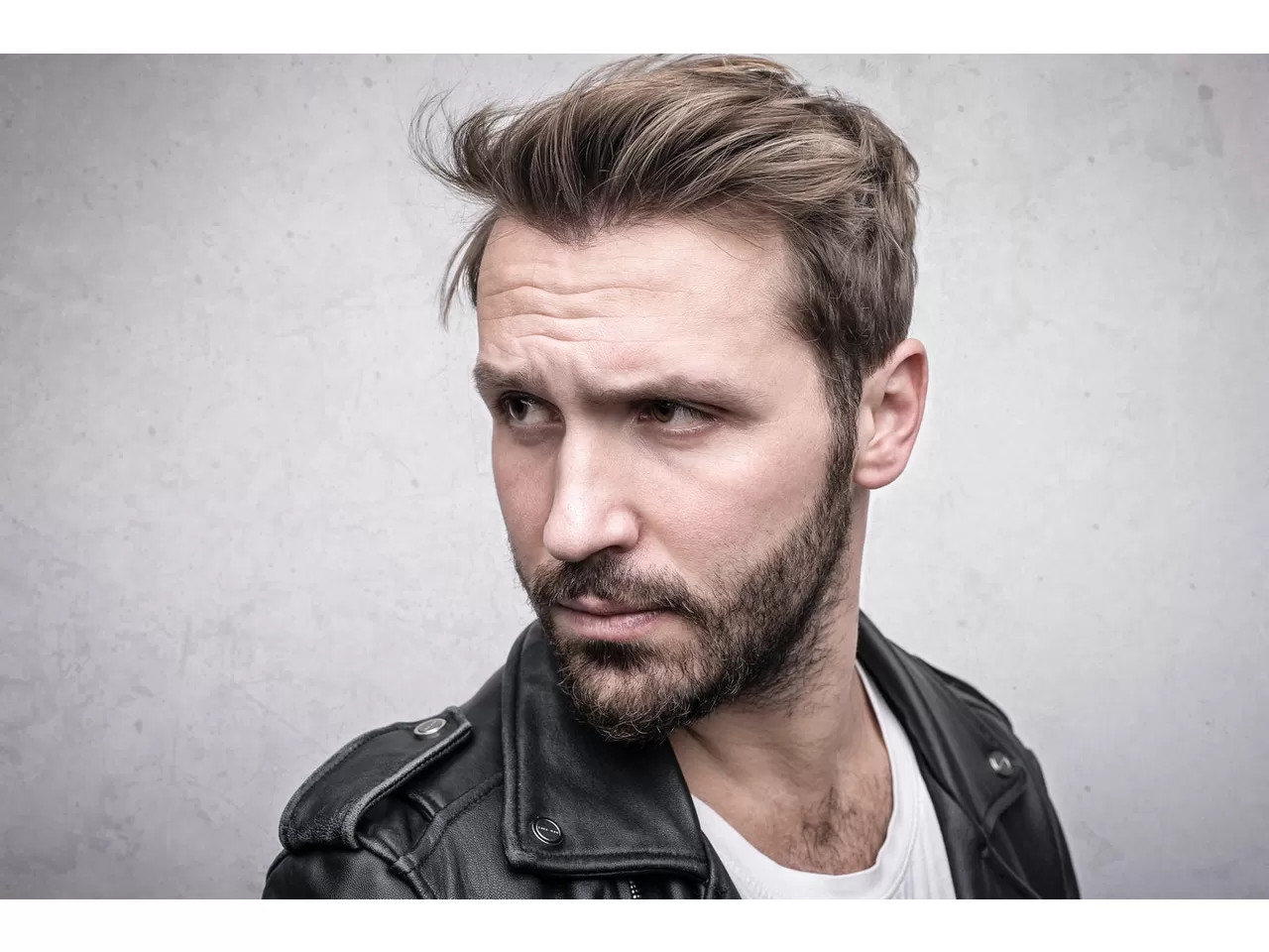 Erkeklerde Neden Saç Kepeği Olur?